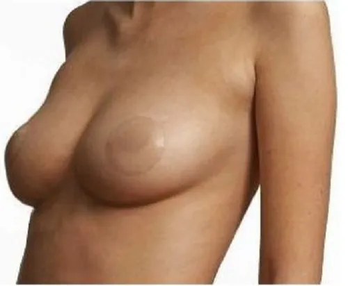 5 x Reusable Nipple Covers Petal Stick On Silicone Nude Boob Cover